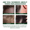 Tinea Scalp Care Shampoo