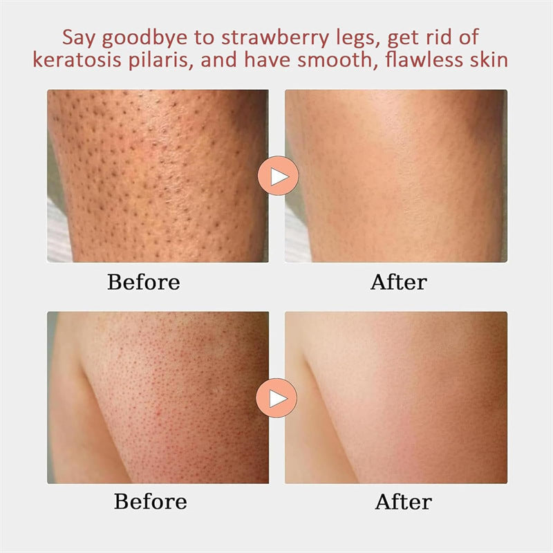 Strawberry Skin Resurfacing Body Cream