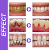 OUHOE Teeth Whitening Essence
