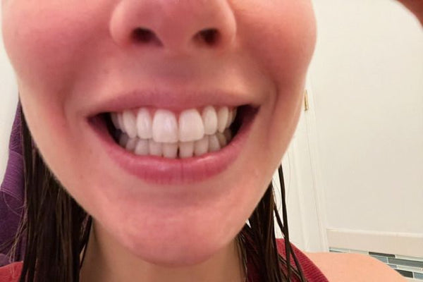 Customer using Gentle Hair Removal Spray