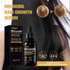 Hair Growth Essence Anti Hair Loss Nutrient Serum